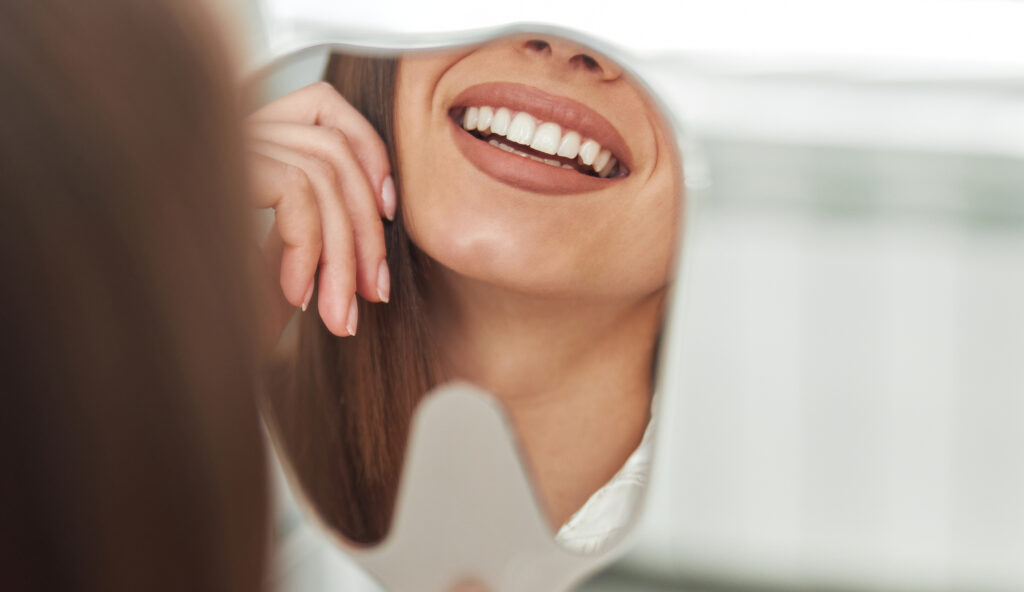 dental bonding heber city ut
