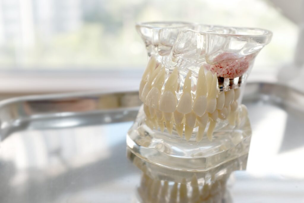 bone grafting Wasatch County