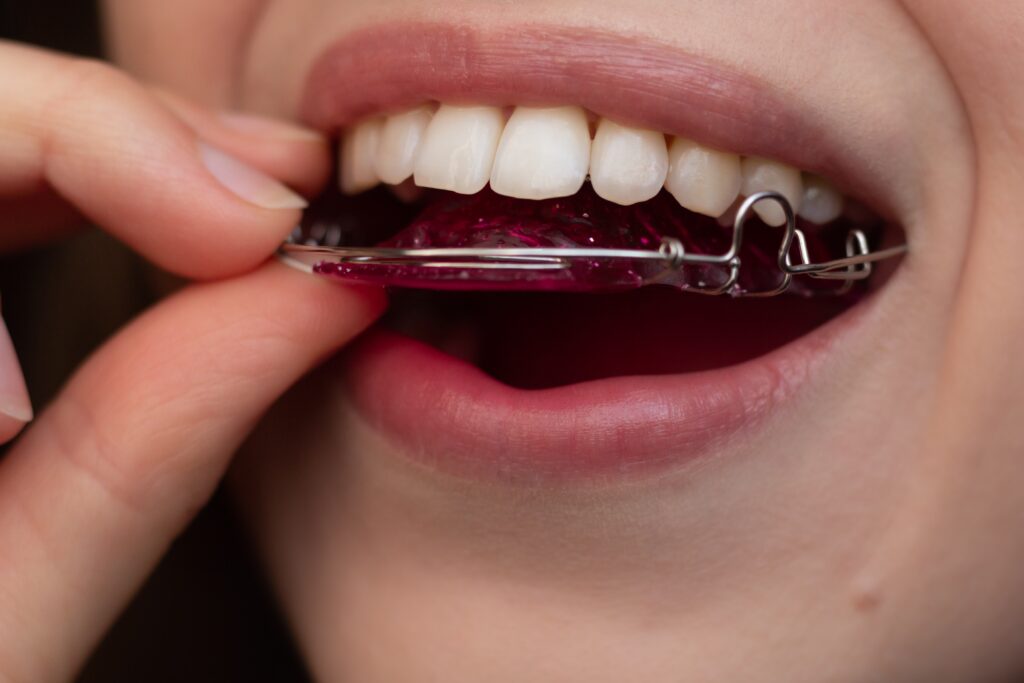 retainers Heber