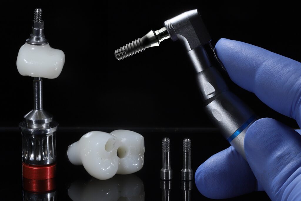 laser dentistry Midway